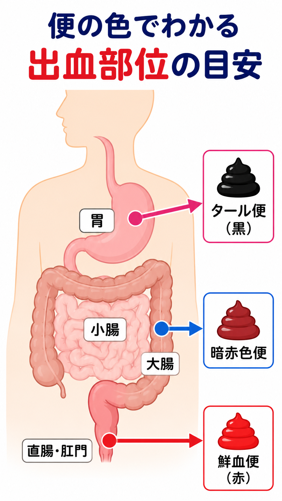 大腸の構造図