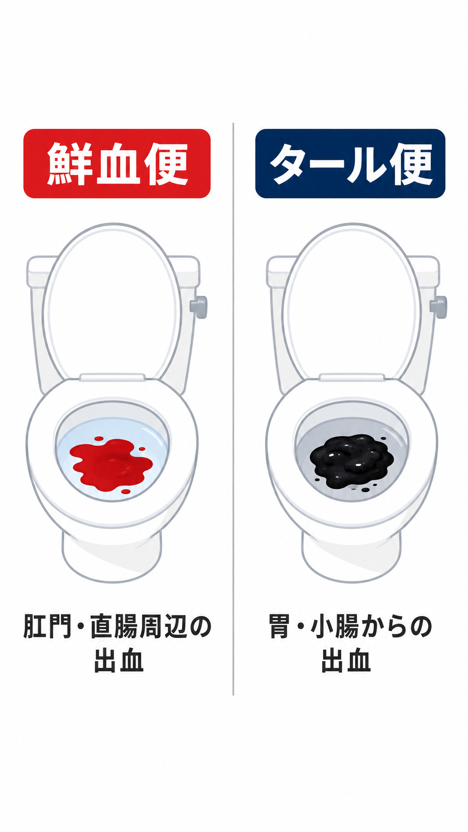 血便の色と種類の説明図